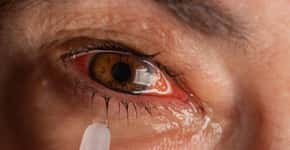 7 fatores que causam a doença do olho seco para você se atentar