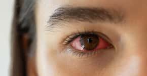 Estas 4 sensações podem indicar a síndrome do olho seco