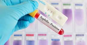 Saiba o que é sífilis congênita, uma doença esquecida e perigosa