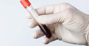 Novo exame de sangue detecta 50 tipos de câncer antes dos sintomas