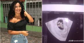 Vídeo de jovem descobrindo gravidez de quíntuplos viraliza; assista
