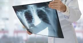 Câncer de pulmão: 13 sintomas para prestar a atenção