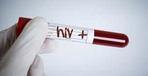 Descoberta variante genética que parece limitar a infecção pelo HIV