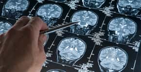 Condição de saúde triplica risco de Alzheimer, diz estudo