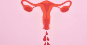 Conheça as causas da irregularidade menstrual