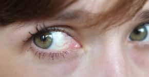 Olhos podem indicar sinal de pressão alta; saiba identificar