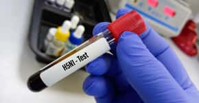 Austrália tem 1º caso de gripe aviária em um humano; veja alerta