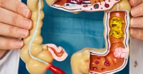 Fatores que podem causar doença de Crohn