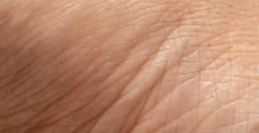 Saiba reconhecer sinal na pele que pode indicar diabetes