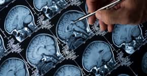 Alzheimer: descubra o primeiro sintoma que surge décadas antes