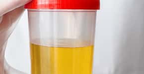 Motivo da urina ficar amarela