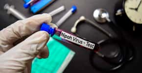 Conheça o vírus Nipah que matou jovem e acende alerta no mundo
