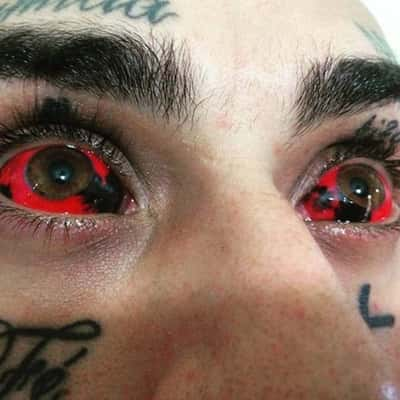 As tatuagens nos olhos podem trazer uma série de riscos (Reprodução)