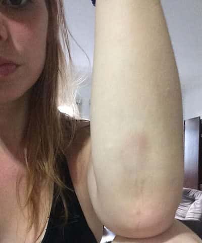 Carolina compartilhou as fotos da agressão nas redes sociais