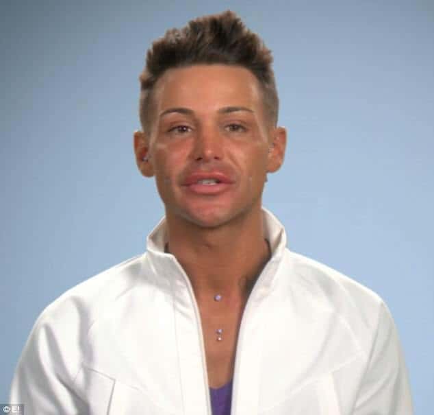 Joey já fez mais de 100 cirurgias plásticas pelo corpo