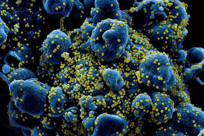 Imagem mostra coronavírus atacando células humanas 