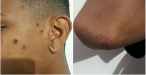 Jovem negro de 16 anos é espancado em mercado na zona sul de SP