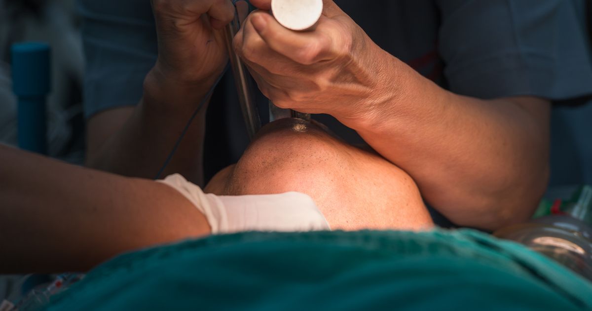 RJ: Sem sedativo, pacientes intubados ficam acordados e amarrados