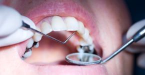 Foto: (garysludden/istock)