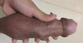 Foto de filhote fálico causa polêmica e é censurada pelo Facebook