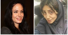 Mulher faz 50 plásticas para ficar igual Angelina Jolie
