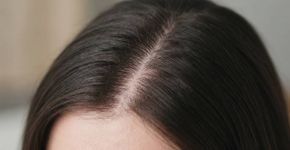 A coceira no couro cabeludo pode ter causas diferentes, e trocar de shampoo sem identificar o motivo nem sempre resolve