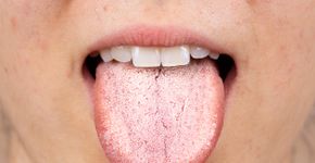 Foto: (iSTock/Wirestock)