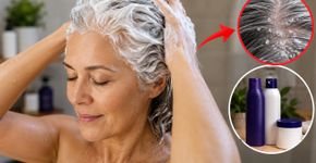 O cabelo com fios brancos exige cuidados alternando dois shampoos, um silver e outro anticaspa, além de ser lavado somente duas vezes por semana