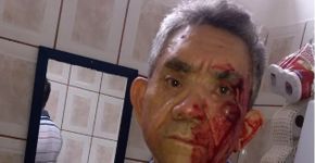 Agredido a socos por aluno, professor decide abandonar profissão