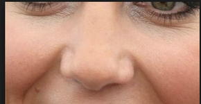 Celebridades inspiram cirurgias plásticas