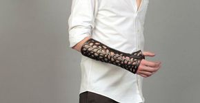 Acessório promete acelerar a cura de ossos quebrados