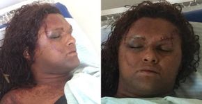 Travesti é espancada a pauladas por dois homens na Paraíba