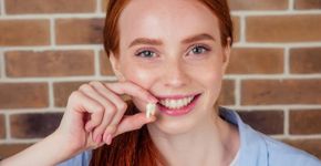 6 mitos e verdades sobre o dente do siso