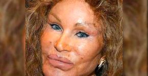 Conhecida por plásticas, socialite volta aos jornais por polêmica