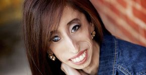 Chamada de a mulher mais feia do mundo, conheça Lizzie Velasquez