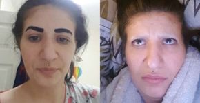 Em vídeo, britânica perde sobrancelhas após usar colorante