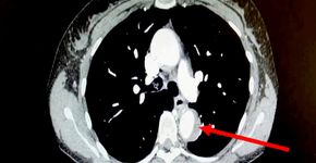 Foto: (American Journal of Cases Report)