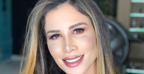 Camilla Uckers comove internet após drama com cirurgia plástica
