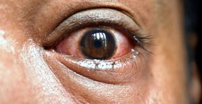 Foto: (iSTock)
