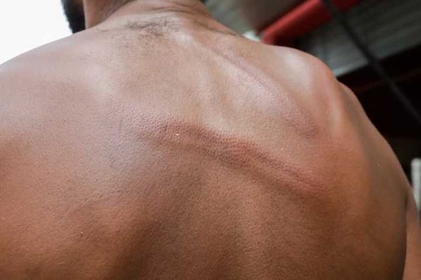 As agressões aos moradores da cracolândia são frequentes