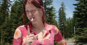 Mulher larga as drogas e viraliza fotos e relato de recuperação