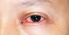 Foto: (Wachira Wacharapathom / iStock)