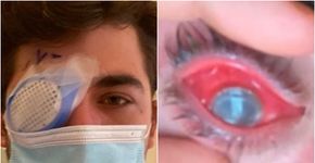Foto: (reprodução/tiktok/Mike Krumholz,)