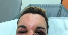 Ativista francês é agredido e estuprado por dois dias