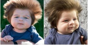 Conheça Cox, talvez o bebê mais cabeludo do mundo