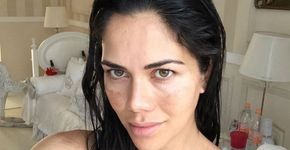 Daniela Albuquerque passa xixi da filha no rosto para curar manchas