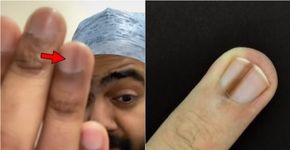 Foto: (reproduçõ/TikTok/dr.karanr)