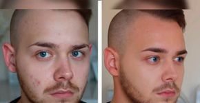 Blogueiro ensina a igualar a pele com base de forma natural