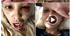 Brasileira expõe agressão de namorado DJ alemão