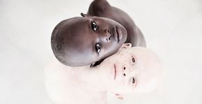 Relato: Fotografei a beleza de crianças albinas na Tanzânia